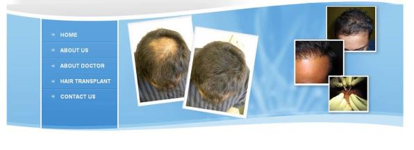 Hair Loss Treatment India